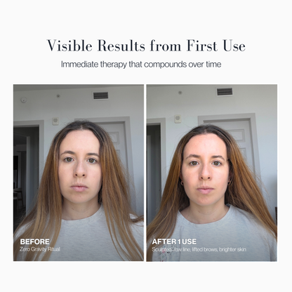 Zero Gravity Facial Cupping + Vitamin C Serum Sculpting Ritual 30ml
