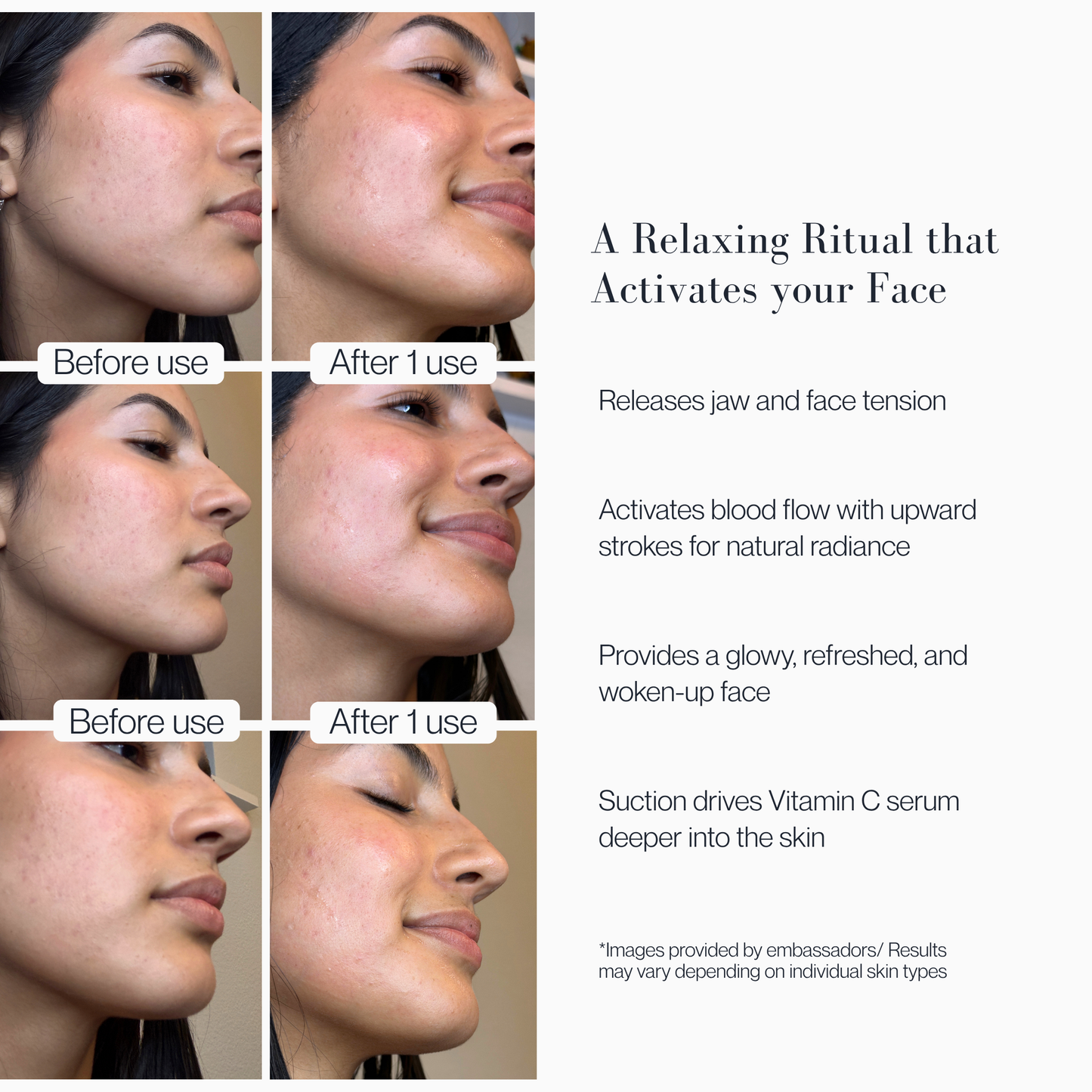 Zero Gravity Facial Cupping + Vitamin C Serum Sculpting Ritual 30ml
